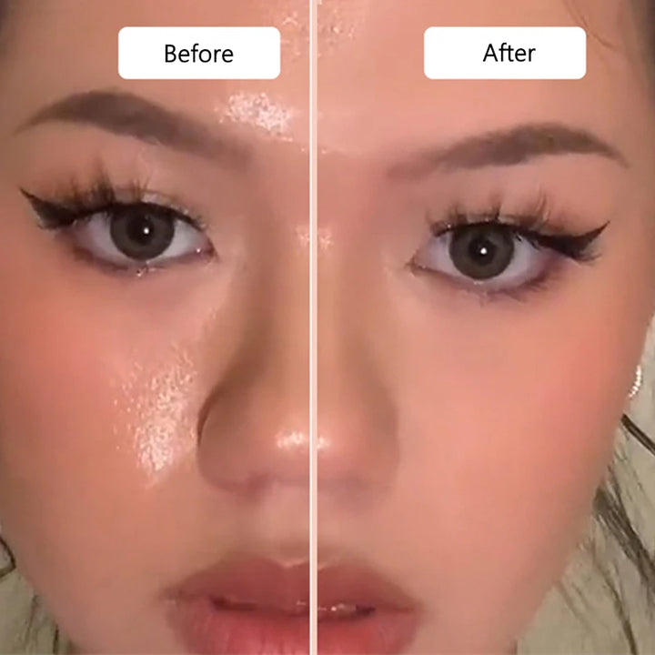 GlowDerma Rouleau Facial Volcanique Absorbant de Sébum | Contrôle Brillance & Réutilisable